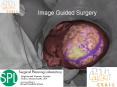 Image Guided Surgery PowerPoint PPT Presentation