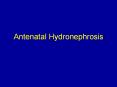 Antenatal Hydronephrosis PowerPoint PPT Presentation