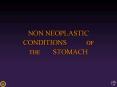 NON NEOPLASTIC CONDITIONS OF THE STOMACH PowerPoint PPT Presentation