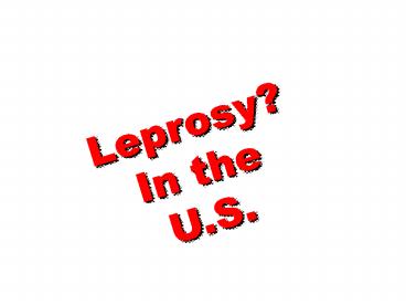 Leprosy