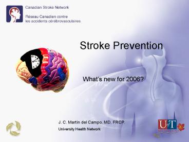 Stroke Prevention
