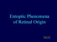 Entoptic Phenomena of Retinal Origin PowerPoint PPT Presentation