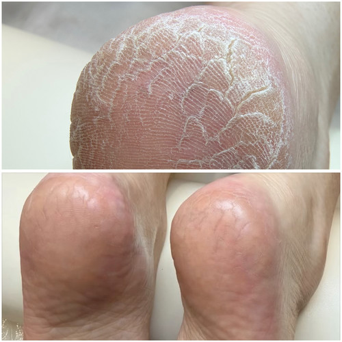 Leezas Spa LLC Sole Therapy by Leeza