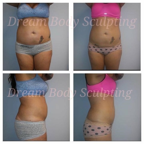 Massage Therapists in Kennesaw, GA Salon Lofts in Kennesaw Kennesaw