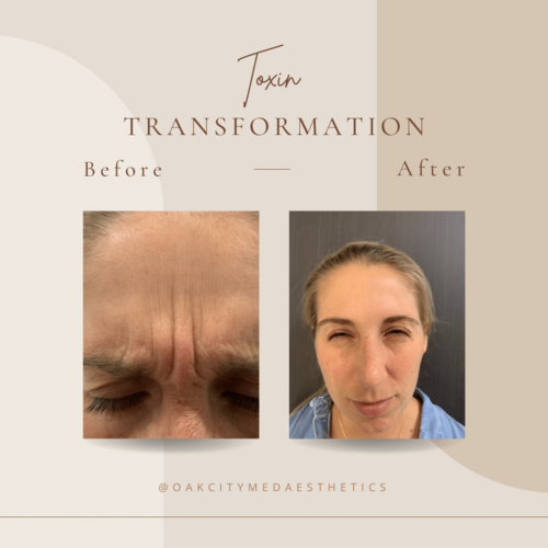 Oak City MedAesthetics Skincare Specialist, Falls of Neuse Olive Park