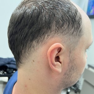 Img 1714
