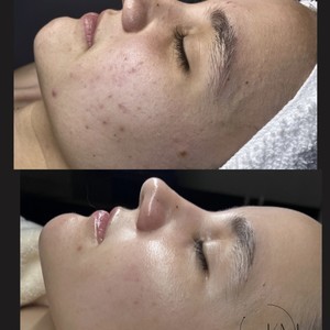 Img 0928