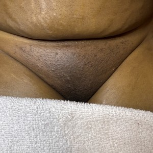 Img 0865