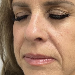 Img 7062