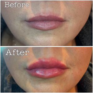 Ce4586c4 6fca 4e56 8c6d 10bfbd2b4ef9