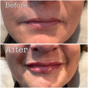 8c4919ea bc92 4e4e 86df cedf492ce475