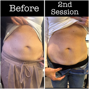 A92a87ef eac0 4b58 8ebb 15c1c843ed88