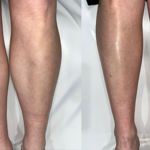 90f138dd 0ad7 49e5 bb6b fdf4860b11b6