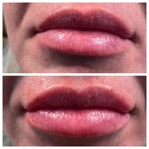 A0855f96 eab0 45c2 8393 267087f00da1