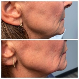 8fc9d17a 4f6d 42e2 b864 ddb497f9d371