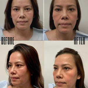 Att.mpyunbaegjx6bvqxevitzl10elqkzsm8ztuycbw7jmy