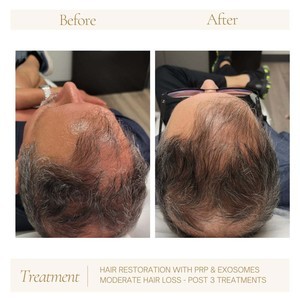 Att.vmyi4sunswovemj c9te fodawb bkrb5cvx29v90f8