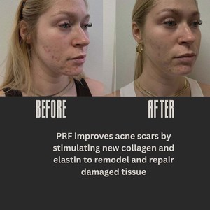 Att.l2fop ulnwbrur7oy2 iwzrzc9rxnjyegexagso07is