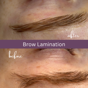 Lamination   cowlick