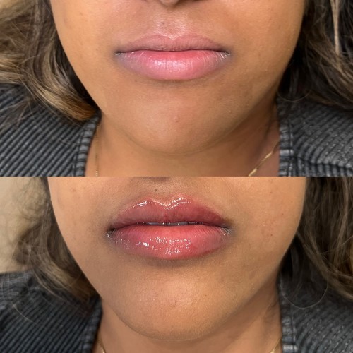 C024fd31 a05c 4169 a37b 8e95a8f4c0a3