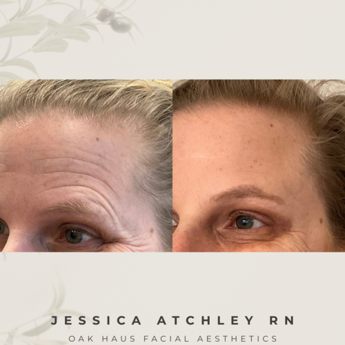 Copy of before and after photos.zip   10