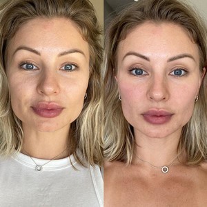 Microcurrent facial b a