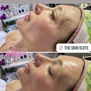 B6d301e1 ec22 407e a58f 4f7afd17180d