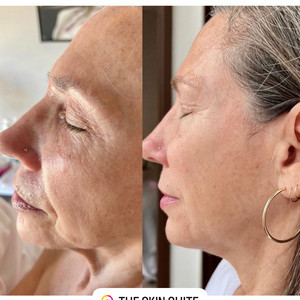 F1bed83f a346 4cf7 8f06 5b4180da92ba