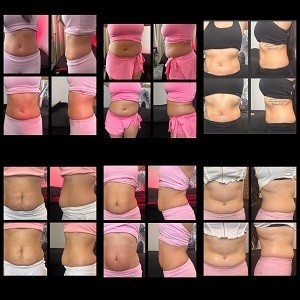 Jan pandm before and afters