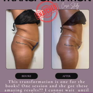 White neutral elegant collage beauty photography before after instagram post