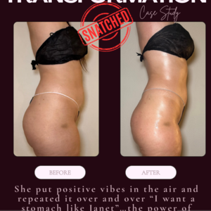 White neutral elegant collage beauty photography before after instagram post