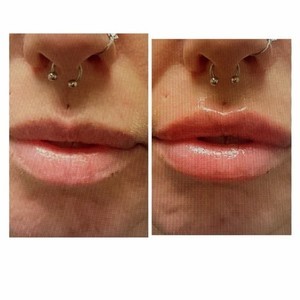 470497a5 199c 4e2b ad3f 49d3082536cb