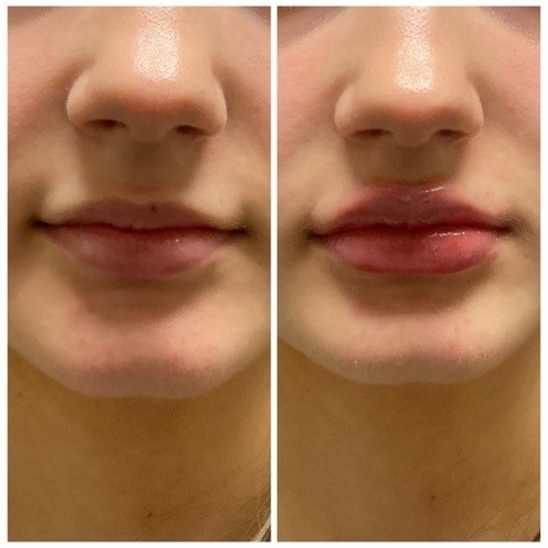 A9d6770b 7541 4875 8174 55c349c1eaf8