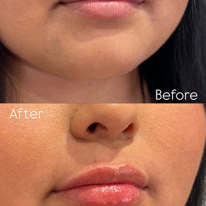 0ea75a7c 99b0 4b37 a60b 1dfc7e561671