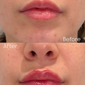 813a55e1 b6ce 4683 bf6e bbb7333275e8