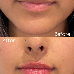 5a254319 31dc 4822 9ce3 5b6fceda2167