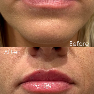 0460a04e 4cce 46b8 abf1 33c27005d741