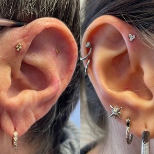 Forward helix
