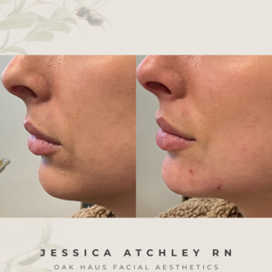 Copy of before and after photos.zip   8