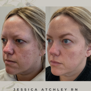 Copy of before and after photos.zip   4