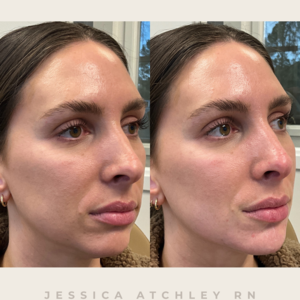 Copy of before and after photos.zip   2