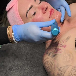 Android 20260325t003503