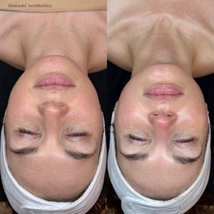 C5964b6d 04b2 4430 a1e3 9043cf002afb