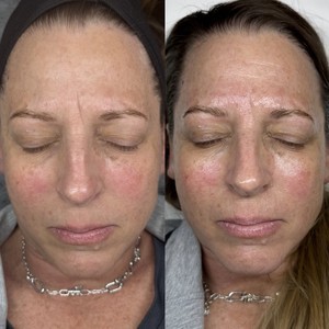 D22f133e e283 48ce b02f e2a3c431d9e7