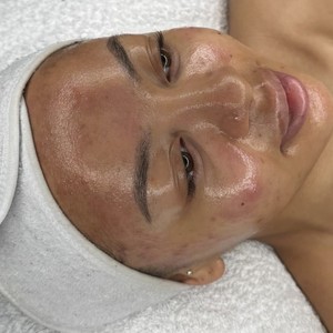 Img 4758