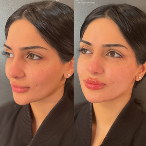 Copy of before and afters %28portrait size%29.zip   1