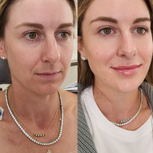 Copy of before and afters %28portrait size%29.png