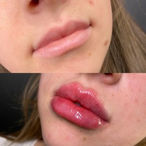 Img 0295