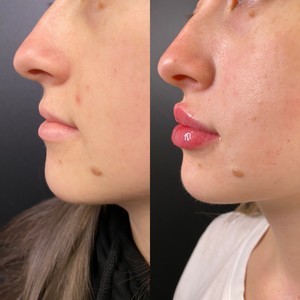 Img 0297