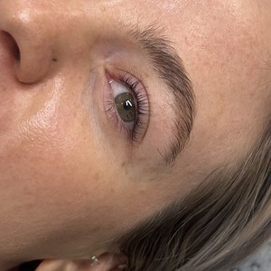 Img 4954